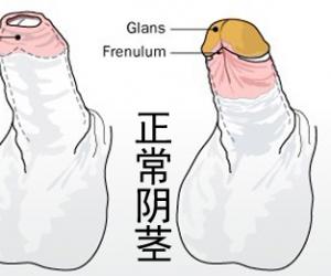 1124236427-0 1124236427-0